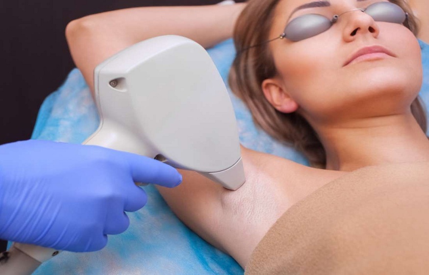 Tips to Care for Your Skin After Laser Hair Removal