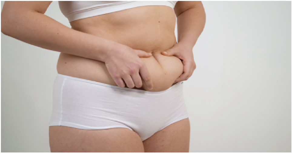 What To Expect Before And After The Tummy Tuck Procedure