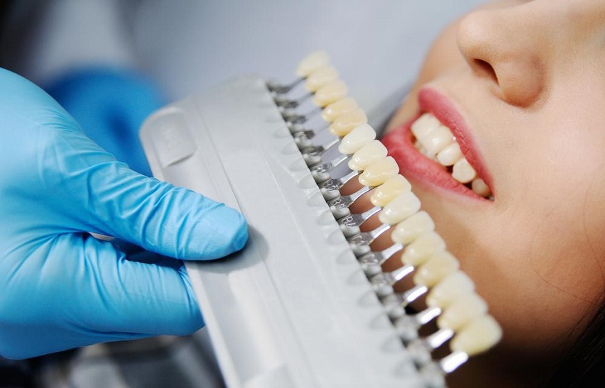 How Dental Crowns can Improve a Patient’s Smile