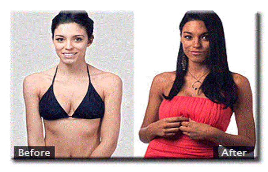 Get The Melanotan 2 Injections To Tan Healthily!