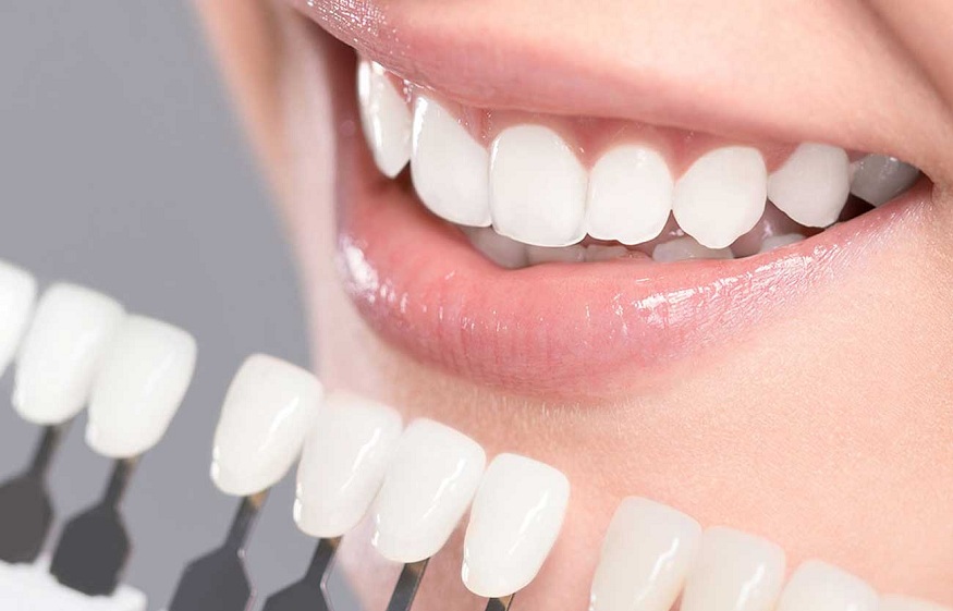 Types of Cosmetic Dentistry and teeth whitening treatment