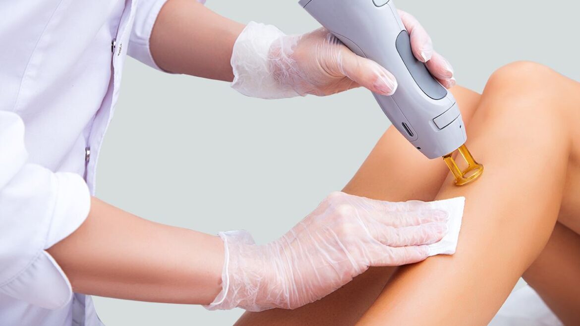 What You Need To Know About Laser Hair Removal