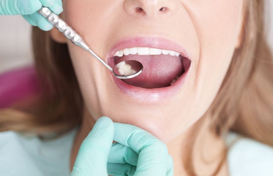 Why Should You Go to a Regular Dental Check-Up?