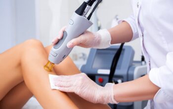 Laser Hair Removal