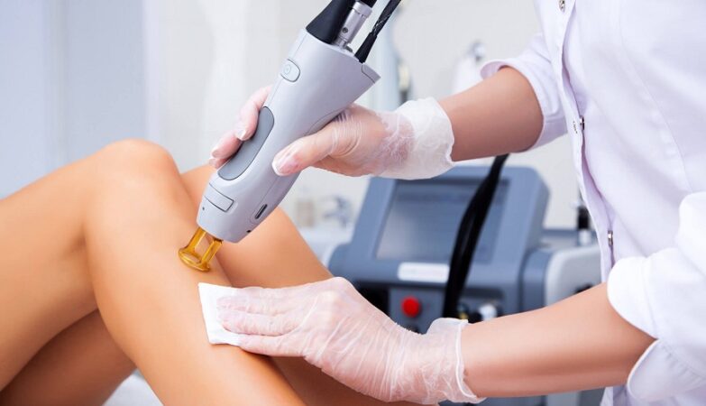 Laser Hair Removal