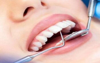 wisdom teeth Sydney
