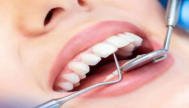 wisdom teeth Sydney