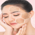 pigmentation on the face