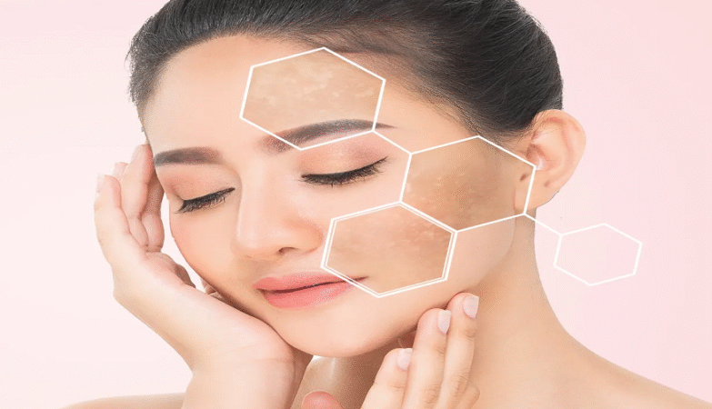 pigmentation on the face