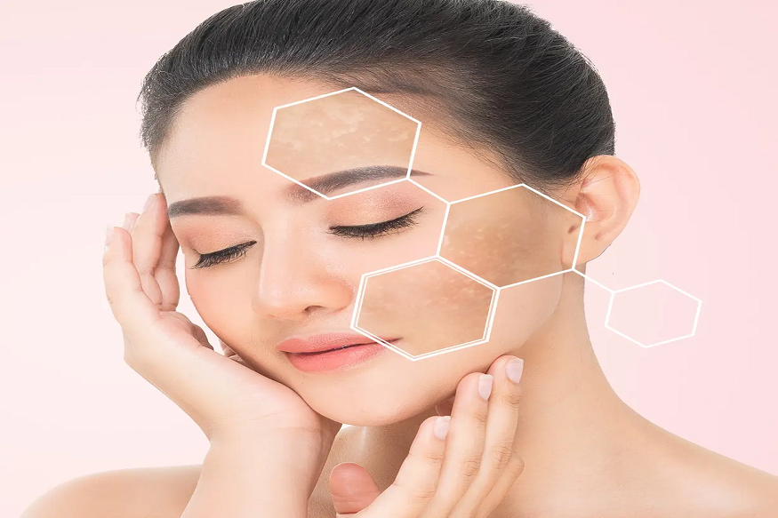 Causes of Pigmentation on the Face and Remedies for Under-Eye Skin