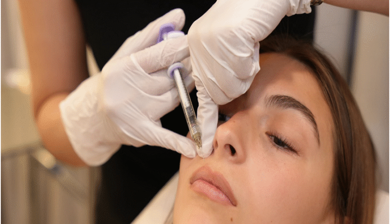 lip injections in Toronto