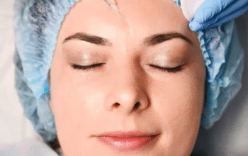 Botox brow lift