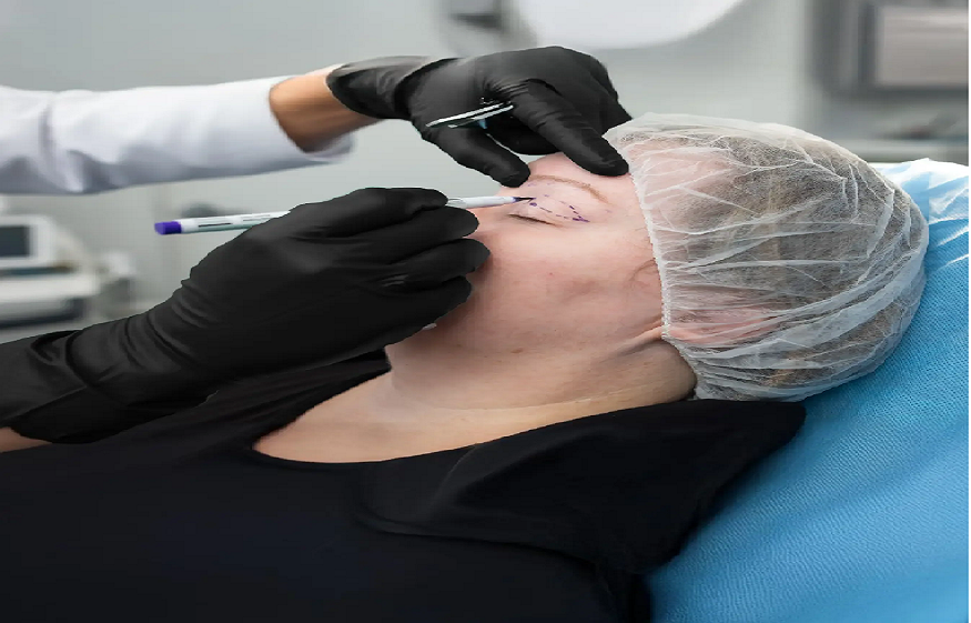 Cosmetic Surgery for Hooded Eyes: Expert Care at Eye FACE Institute, Toronto