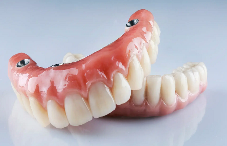 How to Live Confidently with Dentures: Comfort and Care Made Simple