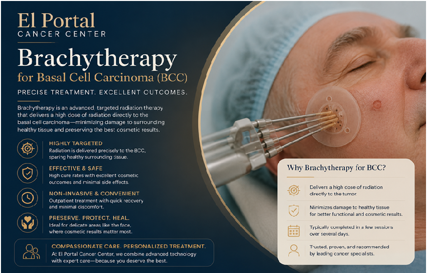 How Brachytherapy for Basal Cell Carcinoma Backs Targeted Skin Cancer Care